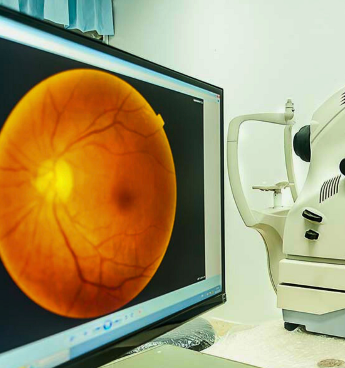 Retinal Images – VISION Optometrists